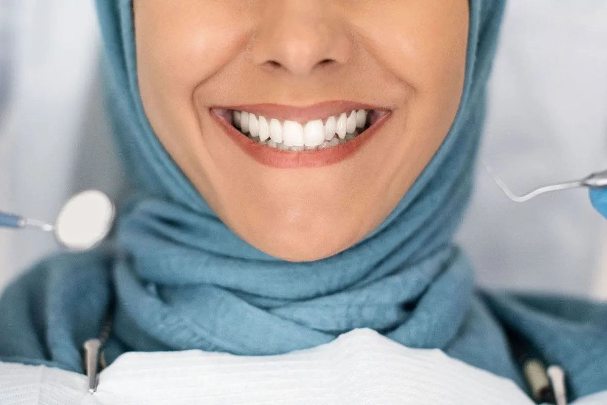 Unique Smiles of McHenry before and after result