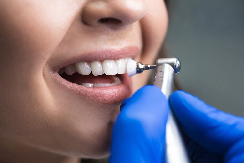 Unique Smiles of McHenry | Dental Cleaning And Examinations