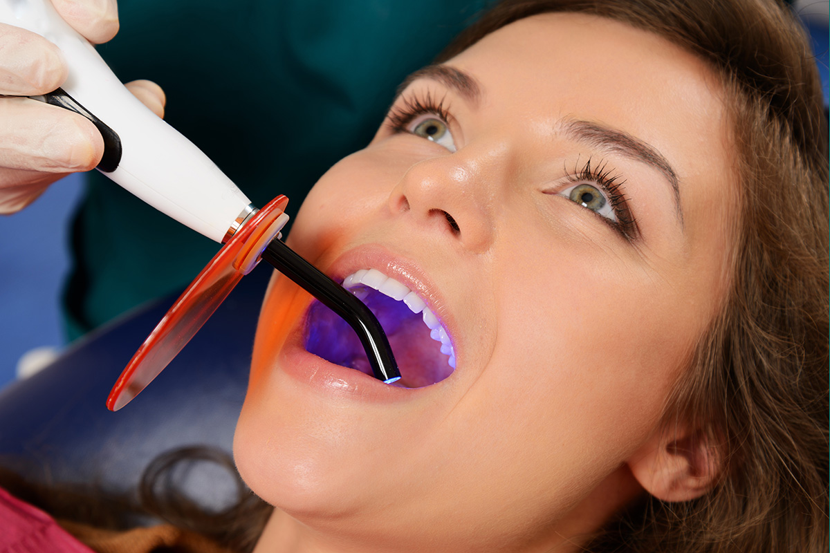 Unique Smiles of McHenry | Preventive Services