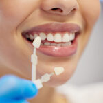 Dental Bonding vs Veneers: Choosing the Right Cosmetic Dentistry Solution