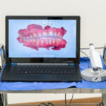 Unique Smiles of McHenry | Do Bleeding Gums Mean You Need a Deep Cleaning in McHenry?