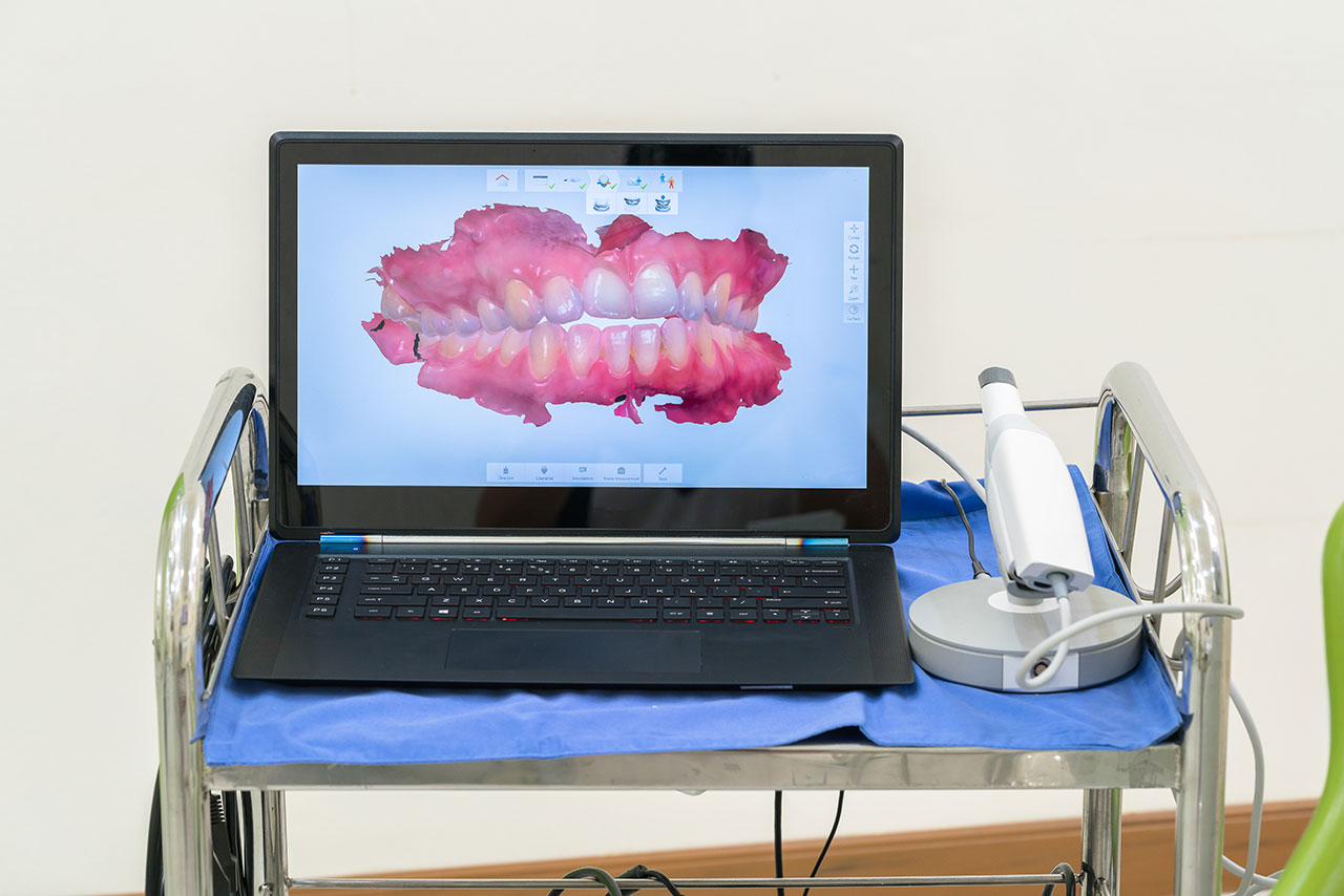 Unique Smiles of McHenry | Do Bleeding Gums Mean You Need a Deep Cleaning in McHenry?